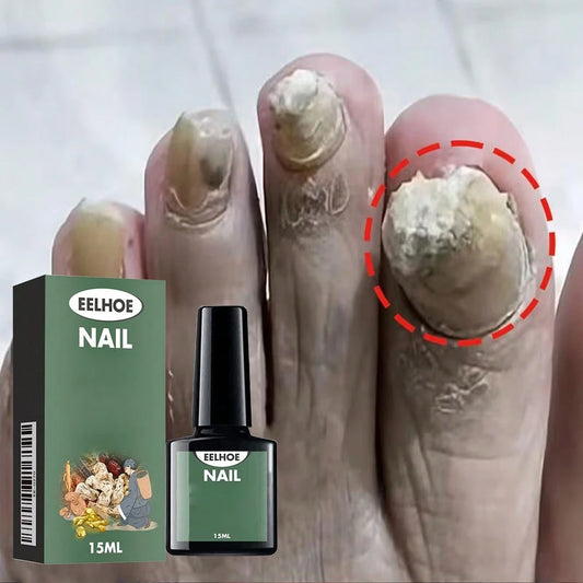 Liquid Intensive Nail Hydrating Cuticle Treatment Oil With Vitamin E And Jojoba Oil Moisturizes Strengthens Nails Promotes Healthy Growth For Daily Nail Care Essential