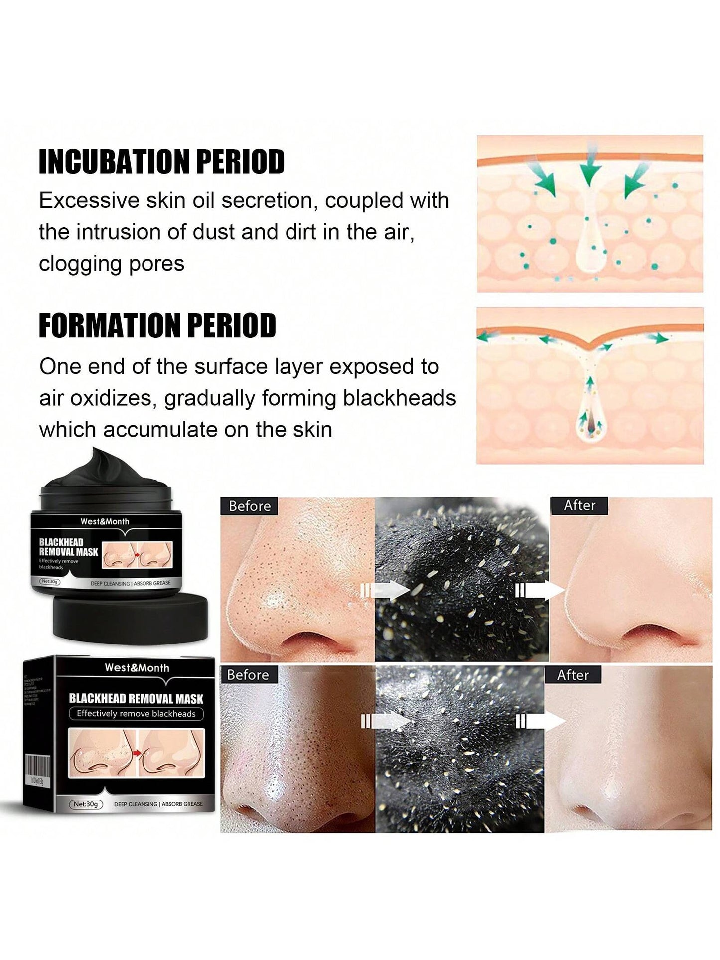 west month Cleaning Blackhead Removal Mask- Peel Off Tear Type Blackhead Removing Activated Carbon Cleaning, Dirts, Pores Facial Mask For Women And Men