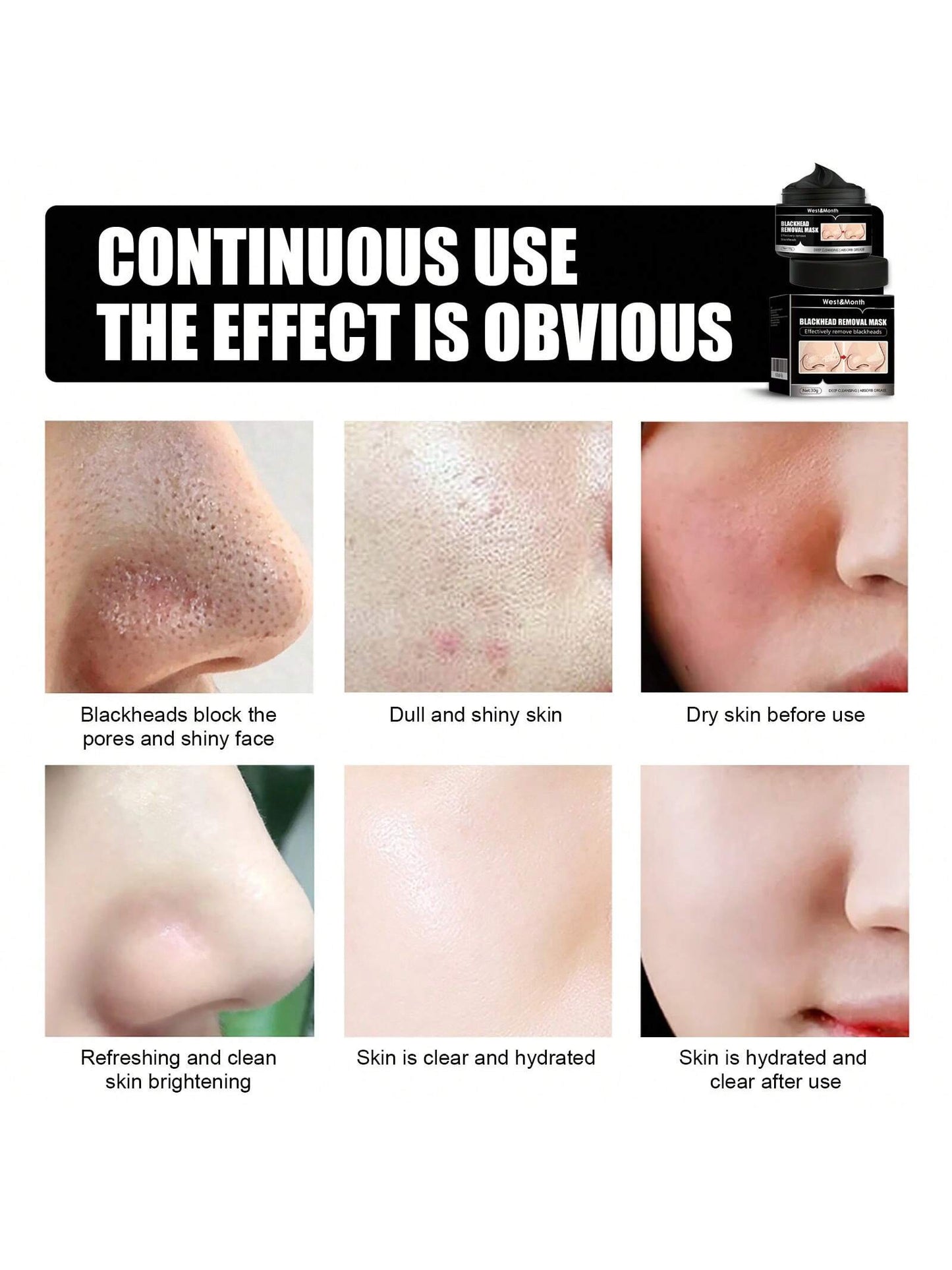 west month Cleaning Blackhead Removal Mask- Peel Off Tear Type Blackhead Removing Activated Carbon Cleaning, Dirts, Pores Facial Mask For Women And Men