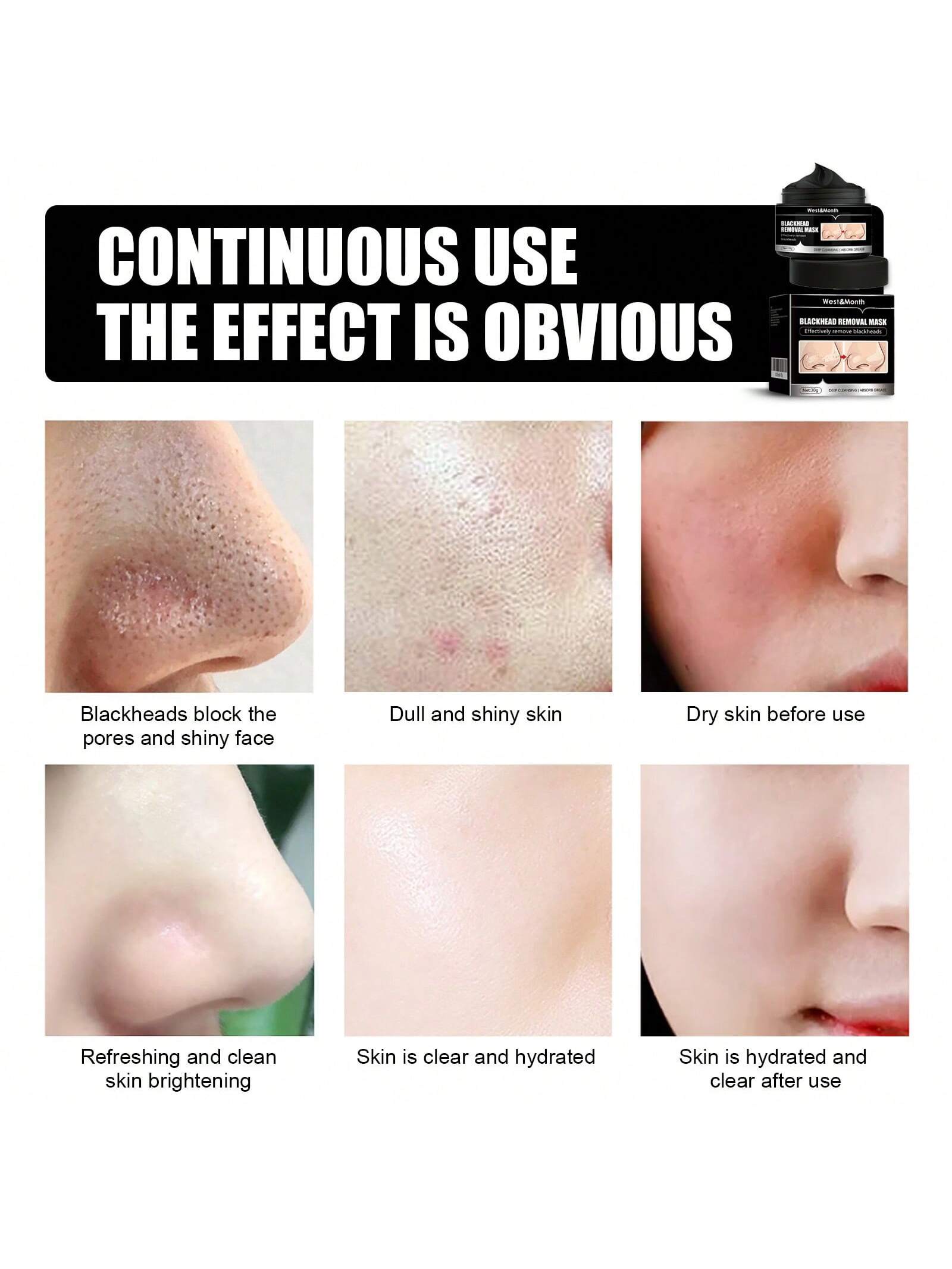 west month Cleaning Blackhead Removal Mask- Peel Off Tear Type Blackhead Removing Activated Carbon Cleaning, Dirts, Pores Facial Mask For Women And Men